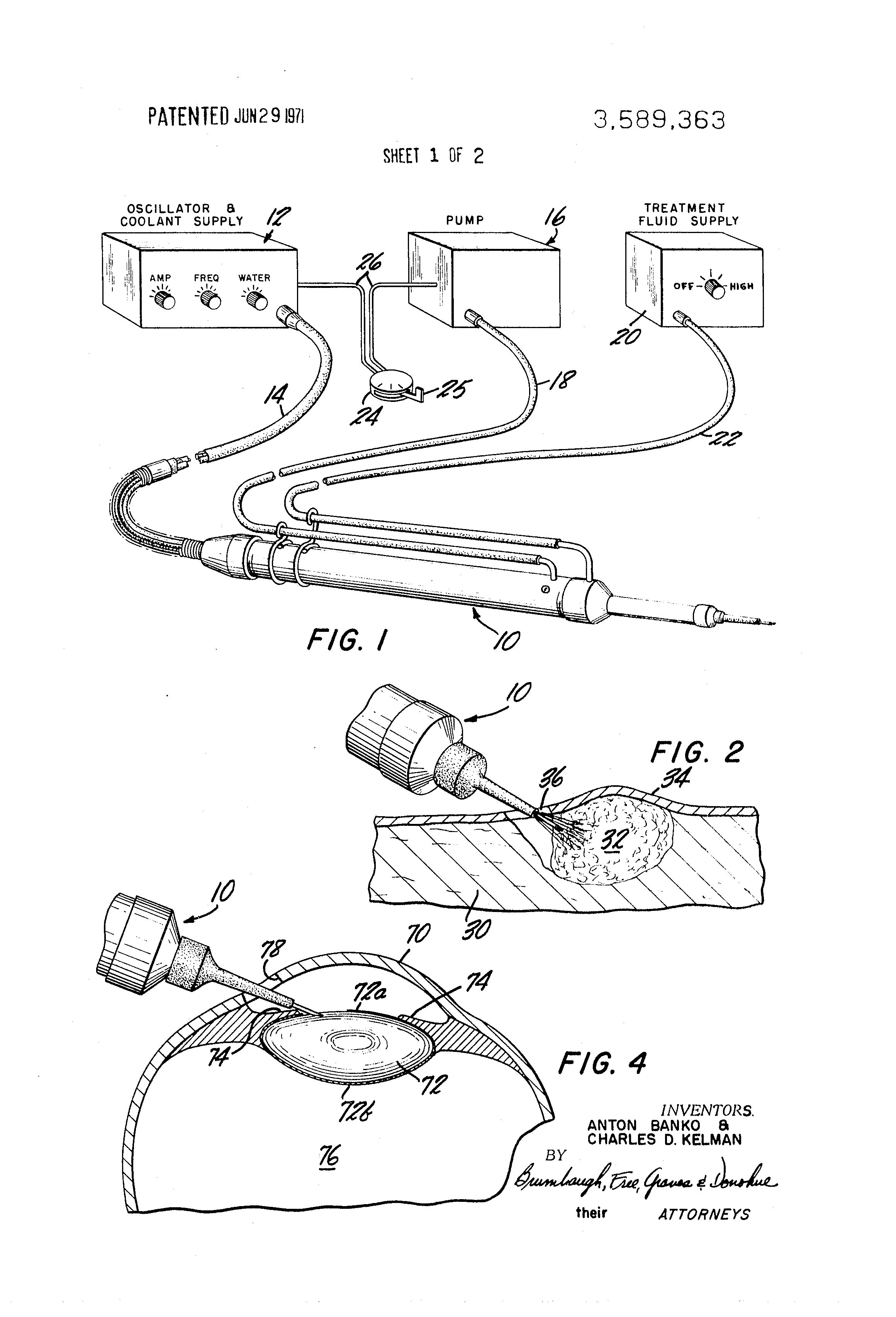 Anton Banko and Charles D. Kelman's Patent